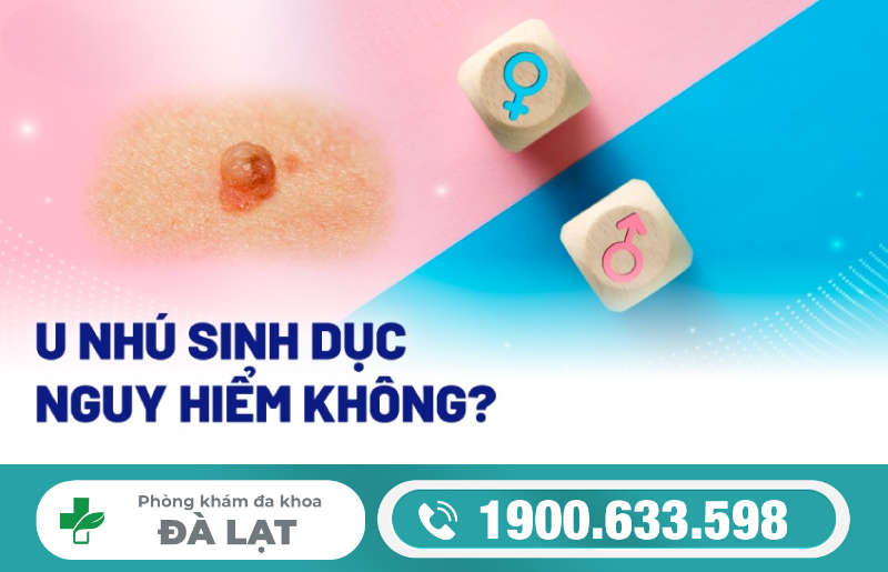 Hình ảnh minh họa